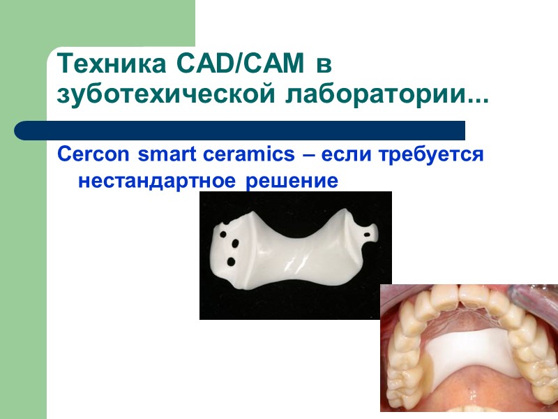 Техника CAD/CAM в зуботехической лаборатории... Cercon smart ceramics – если требуется нестандартное решение